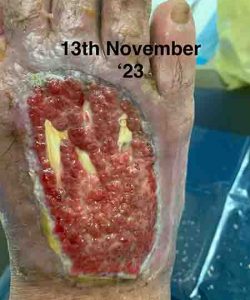 Consumed KGWP After 1 Month | En Wan Testimonial