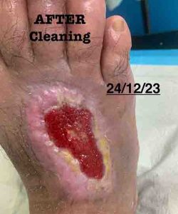 Consumed KGWP After 2 Months | En Wan Testimonial