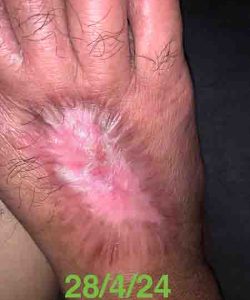 Final Result | En Wan Testimonial